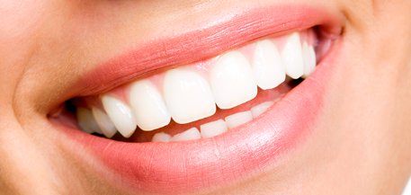 Smile Design